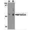 Major facilitator superfamily domain-containing protein 2A antibody, MBS151344, MyBioSource, Western Blot image 