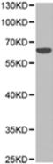 Solute Carrier Family 22 Member 5 antibody, TA321554, Origene, Western Blot image 
