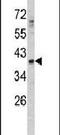 Growth Differentiation Factor 1 antibody, PA5-11930, Invitrogen Antibodies, Western Blot image 