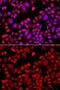 Actin Related Protein 2/3 Complex Subunit 3 antibody, GTX65831, GeneTex, Immunocytochemistry image 