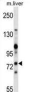 Zeta Chain Of T Cell Receptor Associated Protein Kinase 70 antibody, abx028583, Abbexa, Western Blot image 