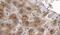 Caseinolytic Mitochondrial Matrix Peptidase Proteolytic Subunit antibody, PA5-18138, Invitrogen Antibodies, Immunohistochemistry paraffin image 
