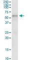 Transcobalamin-1 antibody, H00006947-D01P, Novus Biologicals, Immunoprecipitation image 