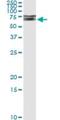 Interleukin 1 Receptor Associated Kinase 1 antibody, H00003654-M02, Novus Biologicals, Immunoprecipitation image 