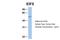 Eukaryotic translation initiation factor 5 antibody, 26-794, ProSci, Western Blot image 