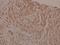 Protein Kinase C Alpha antibody, A00743T505, Boster Biological Technology, Immunohistochemistry paraffin image 