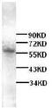 Solute Carrier Family 7 Member 5 antibody, ab85226, Abcam, Western Blot image 