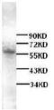 4F2LC antibody, ab85226, Abcam, Western Blot image 