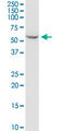 Serine Hydroxymethyltransferase 2 antibody, LS-C198191, Lifespan Biosciences, Western Blot image 