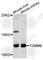 Translocase Of Outer Mitochondrial Membrane 6 antibody, A5240, ABclonal Technology, Western Blot image 