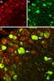 Sodium Voltage-Gated Channel Alpha Subunit 9 antibody, PA5-77727, Invitrogen Antibodies, Immunohistochemistry paraffin image 