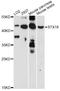 Syntaxin-18 antibody, LS-C749375, Lifespan Biosciences, Western Blot image 