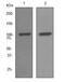 SATB Homeobox 1 antibody, ab92307, Abcam, Western Blot image 
