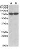 Heat Shock Cognate 70 Interacting Protein antibody, NB100-41377, Novus Biologicals, Western Blot image 