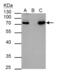 Hematopoietic Cell-Specific Lyn Substrate 1 antibody, GTX114467, GeneTex, Immunoprecipitation image 