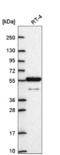 Aryl Hydrocarbon Receptor Nuclear Translocator Like 2 antibody, NBP2-55861, Novus Biologicals, Western Blot image 