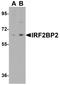 Interferon Regulatory Factor 2 Binding Protein 2 antibody, A05598-1, Boster Biological Technology, Western Blot image 