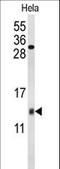 Cytochrome C Oxidase Subunit 5A antibody, LS-C166964, Lifespan Biosciences, Western Blot image 