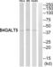 b4Gal-T5 antibody, abx014264, Abbexa, Western Blot image 