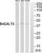 Beta-1,4-Galactosyltransferase 5 antibody, abx014264, Abbexa, Western Blot image 