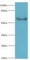 G protein-coupled receptor kinase 6 antibody, LS-C375844, Lifespan Biosciences, Western Blot image 