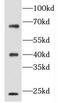 Folliculin antibody, FNab03157, FineTest, Western Blot image 