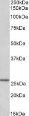 Glucagon Like Peptide 1 Receptor antibody, 43-331, ProSci, Western Blot image 