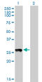 PRELI Domain Containing 1 antibody, LS-C133725, Lifespan Biosciences, Western Blot image 