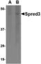 Sprouty Related EVH1 Domain Containing 3 antibody, TA306664, Origene, Western Blot image 