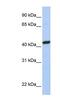 Peroxisomal Biogenesis Factor 10 antibody, NBP1-60050, Novus Biologicals, Western Blot image 