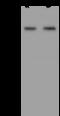 Coiled-Coil Domain Containing 125 antibody, 204814-T40, Sino Biological, Western Blot image 