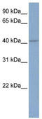 SK4 antibody, TA338529, Origene, Western Blot image 