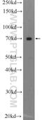 Aggrecan antibody, 13880-1-AP, Proteintech Group, Western Blot image 