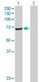 Carnitine O-Octanoyltransferase antibody, H00054677-D01P, Novus Biologicals, Western Blot image 