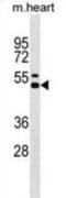 Interleukin 12B antibody, abx030496, Abbexa, Western Blot image 