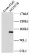 Alpha-1,6-Mannosylglycoprotein 6-Beta-N-Acetylglucosaminyltransferase B antibody, FNab05161, FineTest, Immunoprecipitation image 