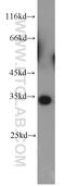CCR4-NOT Transcription Complex Subunit 7 antibody, 14102-1-AP, Proteintech Group, Western Blot image 
