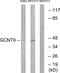 Beta-1,3-galactosyl-O-glycosyl-glycoprotein beta-1,6-N-acetylglucosaminyltransferase 6 antibody, PA5-39051, Invitrogen Antibodies, Western Blot image 