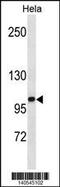 Zinc Fingers And Homeoboxes 1 antibody, 60-539, ProSci, Western Blot image 