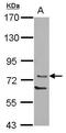 Protein Kinase C Theta antibody, PA5-29089, Invitrogen Antibodies, Western Blot image 