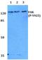 Protein Tyrosine Kinase 2 antibody, A00151Y925, Boster Biological Technology, Western Blot image 