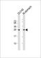 RAB27B, Member RAS Oncogene Family antibody, MBS9216852, MyBioSource, Western Blot image 