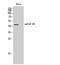 Cholinergic Receptor Muscarinic 2 antibody, STJ93977, St John