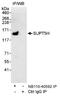 SPT5 Homolog, DSIF Elongation Factor Subunit antibody, NB110-40592, Novus Biologicals, Western Blot image 