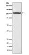 Heat Shock Protein Family H (Hsp110) Member 1 antibody, M04168, Boster Biological Technology, Western Blot image 