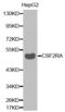 Colony Stimulating Factor 2 Receptor Alpha Subunit antibody, abx001651, Abbexa, Western Blot image 