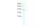 ETS Transcription Factor ELK4 antibody, 28-071, ProSci, Western Blot image 