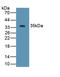 Defensin Beta 4B antibody, LS-C293662, Lifespan Biosciences, Western Blot image 