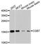 Choriogonadotropin subunit beta antibody, A8522, ABclonal Technology, Western Blot image 