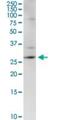 Centromere Protein H antibody, H00064946-D01P, Novus Biologicals, Western Blot image 